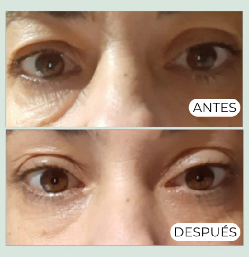 Contorno Ojos Antiedad con Aguacate, te verde y cafeína de Alma Secret BETH'S HAIR Contorno Ojos Antiedad con Aguacate, te verde y cafeína de Alma Secret BETH'S HAIR