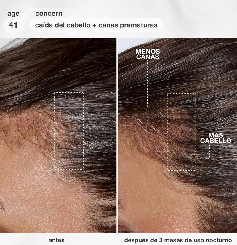 Sérum biomimético capilar de longevidad y anticaída FutureIQ™ biomimetic hair longevity serum de K18 BETH'S HAIR Sérum biomimético capilar de longevidad y anticaída FutureIQ™ biomimetic hair longevity serum de K18 BETH'S HAIR